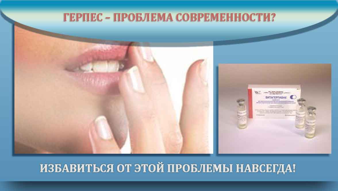 Витагерпавак вакцина от герпеса