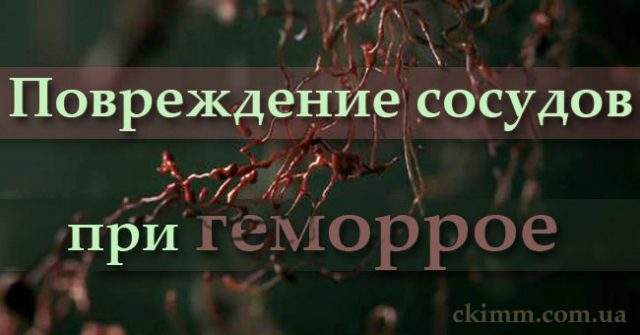 Повреждение сосудов при геморрое на ранних стадиях Причины развития геморроя всех стадий